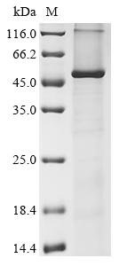 Recombinant Human Acyl-CoA 6-desaturase (FADS2) Protein, Homo sapiens (Human), in vitro E.coli expression system, N-terminal 10xHis-tagged, 53.8kDa, purity >85% as determined by SDS-PAGE.