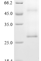 (Tris-Glycine gel) Discontinuous SDS-PAGE (reduced) with 5% enrichment gel and 15% separation gel.