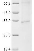 (Tris-Glycine gel) Discontinuous SDS-PAGE (reduced) with 5% enrichment gel and 15% separation gel.
