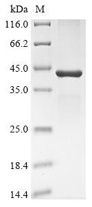 Recombinant Xenopus tropicalis Hyaluronan synthase 1 (has1), partial