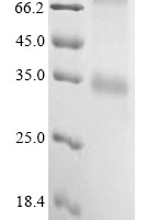 (Tris-Glycine gel) Discontinuous SDS-PAGE (reduced) with 5% enrichment gel and 15% separation gel.