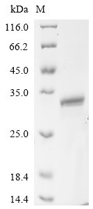 Recombinant Mouse Heme-binding protein 1 (Hebp1)