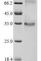 (Tris-Glycine gel) Discontinuous SDS-PAGE (reduced) with 5% enrichment gel and 15% separation gel.