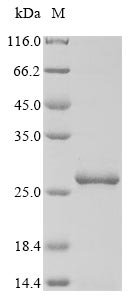 Recombinant Mycoplasma pneumoniae Cytadherence high molecular weight protein 1 (hmw1), partial, Mycoplasma pneumoniae (strain ATCC 29342 / M129), E.coli, N-terminal 10xHis-tagged and C-terminal Myc-tagged, 22.0kDa, purity >90% as determined by SDS-PAGE.