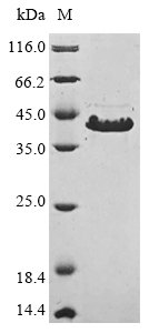 Recombinant Mycoplasma pneumoniae Cytadherence high molecular weight protein 3 (hmw3), partial, Mycoplasma pneumoniae (strain ATCC 29342 / M129), E.coli, N-terminal 10xHis-tagged and C-terminal Myc-tagged, 27.1kDa, purity >85% as determined by SDS-PAGE.