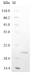 Recombinant Human parainfluenza 1 virus Hemagglutinin-neuraminidase (HN), partial