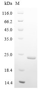 Recombinant Human parainfluenza 2 virus Hemagglutinin-neuraminidase (HN), partial, Human parainfluenza 2 virus (strain Toshiba) (HPIV-2), E.coli, N-terminal 10xHis-tagged, 20.5kDa, purity >90% as determined by SDS-PAGE.