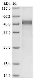 Recombinant Newcastle disease virus Hemagglutinin-neuraminidase (HN), partial, Newcastle disease virus (strain Her/33) (NDV), E.coli, N-terminal 6xHis-tagged, 45.1kDa, purity >90% as determined by SDS-PAGE.