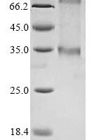 (Tris-Glycine gel) Discontinuous SDS-PAGE (reduced) with 5% enrichment gel and 15% separation gel.