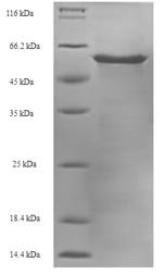 Recombinant Bovine Heterogeneous nuclear ribonucleoproteins A2/B1 (HNRNPA2B1), Bos taurus (Bovine), E.coli, N-terminal 6xHis-SUMO-tagged, 52.0kDa, purity >90% as determined by SDS-PAGE.