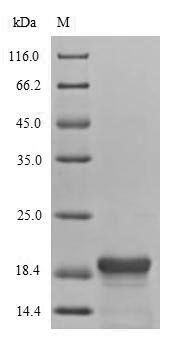 Recombinant SerRatia marcescens DNA-binding protein H-NS (hns), Serratia marcescens, E.coli, N-terminal 6xHis-tagged, 19.5kDa, purity >90% as determined by SDS-PAGE.