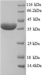 Recombinant Rat Haptoglobin (Hp), partial, Rattus norvegicus (Rat), E.coli, N-terminal 6xHis-tagged, 40.5kDa, purity >90% as determined by SDS-PAGE.