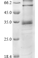 (Tris-Glycine gel) Discontinuous SDS-PAGE (reduced) with 5% enrichment gel and 15% separation gel.