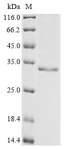 Recombinant Rat 17-beta-hydroxysteroid dehydrogenase 13 (Hsd17b13)