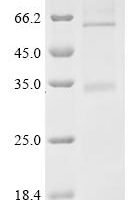 (Tris-Glycine gel) Discontinuous SDS-PAGE (reduced) with 5% enrichment gel and 15% separation gel.