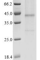 (Tris-Glycine gel) Discontinuous SDS-PAGE (reduced) with 5% enrichment gel and 15% separation gel.