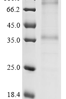 (Tris-Glycine gel) Discontinuous SDS-PAGE (reduced) with 5% enrichment gel and 15% separation gel.