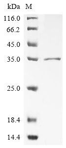 Recombinant Streptococcus pyogenes Immunoglubulin-degrading enzyme (ideS)