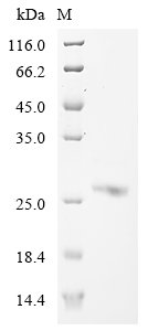 Recombinant Mouse Interferon-activable protein 204 (Ifi204), partial, Mus musculus (Mouse), E.coli, N-terminal 6xHis-tagged, 28.7kDa, purity >85% as determined by SDS-PAGE.