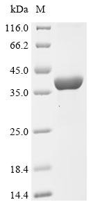 Recombinant Mouse Interferon-induced 35 kDa protein homolog (Ifi35), Mus musculus (Mouse), E.coli, N-terminal 10xHis-tagged, 37.9kDa, purity >90% as determined by SDS-PAGE.
