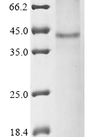 (Tris-Glycine gel) Discontinuous SDS-PAGE (reduced) with 5% enrichment gel and 15% separation gel.