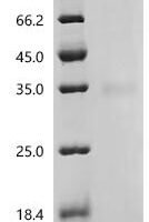 (Tris-Glycine gel) Discontinuous SDS-PAGE (reduced) with 5% enrichment gel and 15% separation gel.