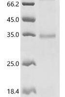 (Tris-Glycine gel) Discontinuous SDS-PAGE (reduced) with 5% enrichment gel and 15% separation gel.