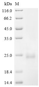 Recombinant Sigmodon hispidus Interferon gamma (IFNG), Sigmodon hispidus (Hispid cotton rat), Yeast, C-terminal 6xHis-tagged, 18.9kDa, purity >90% as determined by SDS-PAGE.