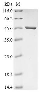 Recombinant Chicken Indian hedgehog protein (IHH), Gallus gallus (Chicken), E.coli, N-terminal 10xHis-tagged and C-terminal Myc-tagged, 47.5kDa, purity >90% as determined by SDS-PAGE.