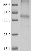 (Tris-Glycine gel) Discontinuous SDS-PAGE (reduced) with 5% enrichment gel and 15% separation gel.