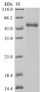Recombinant Rat Interleukin-11 (Il11)