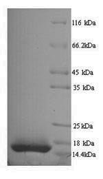 Recombinant Macaca mulatta Interleukin-15 (IL15)
