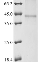 (Tris-Glycine gel) Discontinuous SDS-PAGE (reduced) with 5% enrichment gel and 15% separation gel.