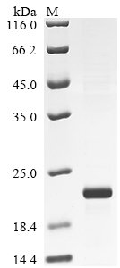 Recombinant Rat Interleukin-17A (Il17a), Rattus norvegicus (Rat), E.coli, N-terminal 6xHis-tagged, 21.0kDa, purity >90% as determined by SDS-PAGE.
