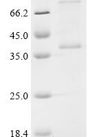 (Tris-Glycine gel) Discontinuous SDS-PAGE (reduced) with 5% enrichment gel and 15% separation gel.