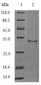 Recombinant Mouse Interleukin-1 family member 10 (Il1f10)