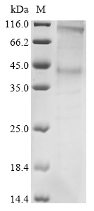 Recombinant Bovine Rhodopsin (RHO) Protein, Bos taurus (Bovine), in vitro E.coli expression system, N-terminal 6xHis-tagged, 45.0kDa, purity >85% as determined by SDS-PAGE.