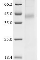 (Tris-Glycine gel) Discontinuous SDS-PAGE (reduced) with 5% enrichment gel and 15% separation gel.