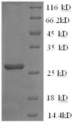 Recombinant mouse Interleukin-2 receptor subunit beta (Il2rb), partial