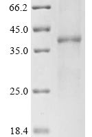 (Tris-Glycine gel) Discontinuous SDS-PAGE (reduced) with 5% enrichment gel and 15% separation gel.