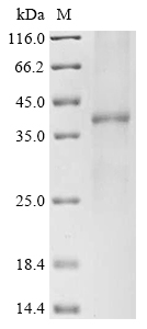 Recombinant Human Urea transporter 1 (SLC14A1) Protein, Homo sapiens (Human), in vitro E.coli expression system, N-terminal 10xHis-tagged, 48.6kDa, purity >85% as determined by SDS-PAGE.