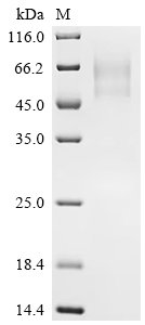 Recombinant Pig Interleukin-6 receptor subunit alpha (IL6R), partial