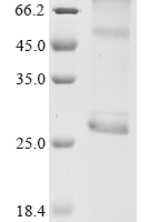 (Tris-Glycine gel) Discontinuous SDS-PAGE (reduced) with 5% enrichment gel and 15% separation gel.