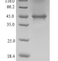 (Tris-Glycine gel) Discontinuous SDS-PAGE (reduced) with 5% enrichment gel and 15% separation gel.