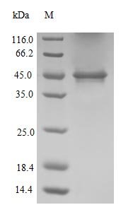 (Tris-Glycine gel) Discontinuous SDS-PAGE (reduced) with 5% enrichment gel and 15% separation gel.
