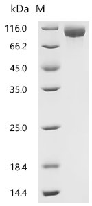 Recombinant Mouse Integrin beta-6 (Itgb6), partial, Mus musculus (Mouse), Mammalian cell, C-terminal 10xHis-tagged, 76.3kDa, purity >95% as determined by SDS-PAGE.
