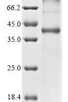 (Tris-Glycine gel) Discontinuous SDS-PAGE (reduced) with 5% enrichment gel and 15% separation gel.