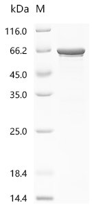 Recombinant Rat Klotho (Kl), partial, Rattus norvegicus (Rat), E.coli, N-terminal 6xHis-tagged, 64.9kDa, purity >85% as determined by SDS-PAGE.