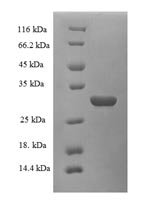 Recombinant Rat Plasma kallikrein (Klkb1), partial