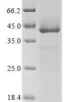 (Tris-Glycine gel) Discontinuous SDS-PAGE (reduced) with 5% enrichment gel and 15% separation gel.